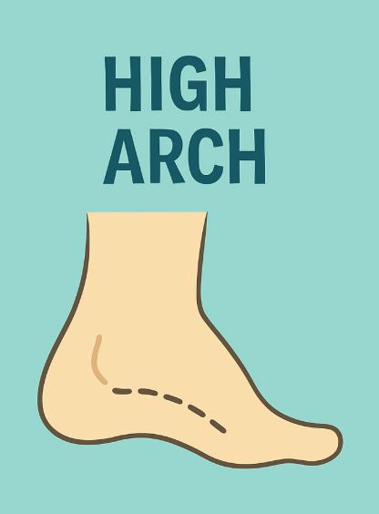 Women's Sport (High Arch Feet)